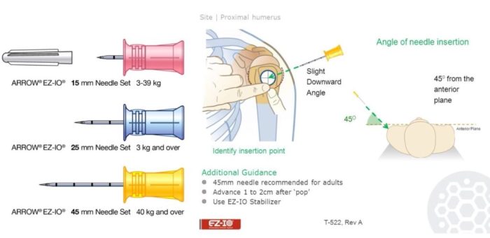 Intraosseous infusion io ez system kit g3 ezio medical